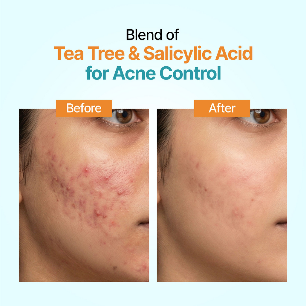 Acnull Facewash 70gm by Sarumam Pharmacy – Chennai